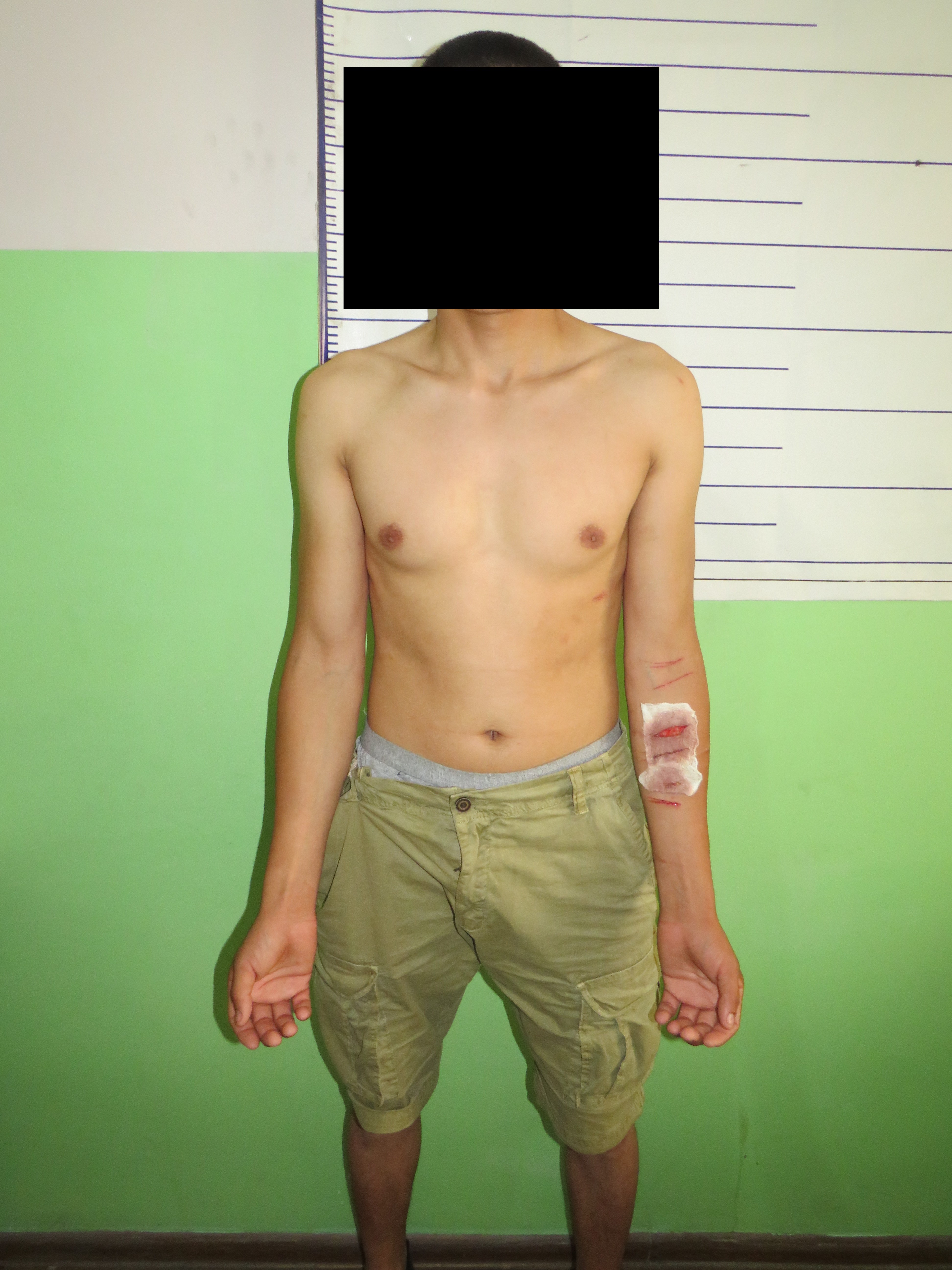Задержанный в ИВС заявил, что его пытали сотрудники Ленинского РУВД и, не выдержав пытки, он порезал себе руки.