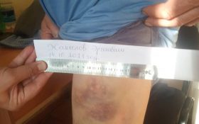 (Рус) «Били и угрожали сексуальным насилием»: в Узгене пенсионер обвинил милиционеров в применении пыток